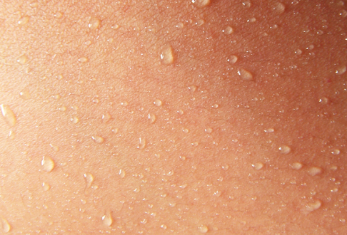 Sudore eccessivo? Prevenzione e rimedi